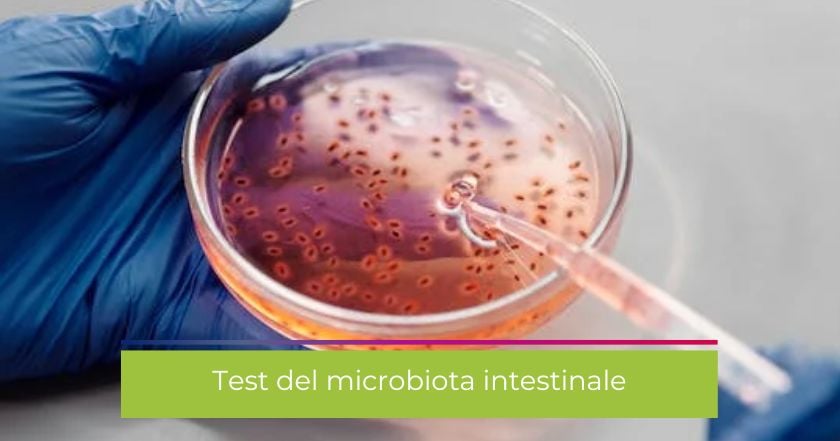 microbiota-test-intestino-batteri-coltura-laboratorio-disbiosi
